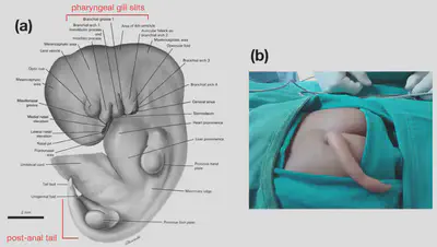 **(a)**: human embryo at week 6 ([Gasser, 1975](https://www.ehd.org/pdf/gasser/greyscale/Gasser_Fig6-1gs.pdf)). **(b)**: a rare disorder where the tail persists until birth (an atavistic trait) ([Shad & Biswas, 2012](https://casereports.bmj.com/content/2012/bcr.11.2011.5160)).