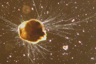 A rhizarian protist.